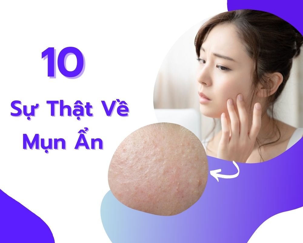 10 su that ve mun an duoi da va cach dieu tri hieu qua nhat 16