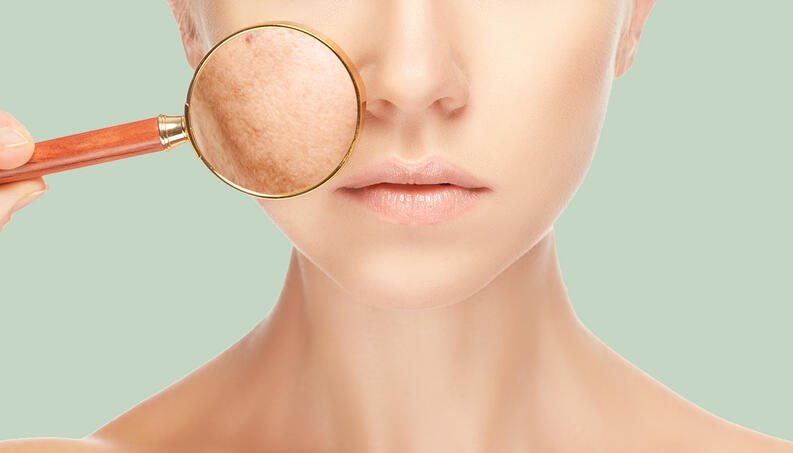 tri nam chan sau co kho khong cach cham soc da ngua nam chan sau 9