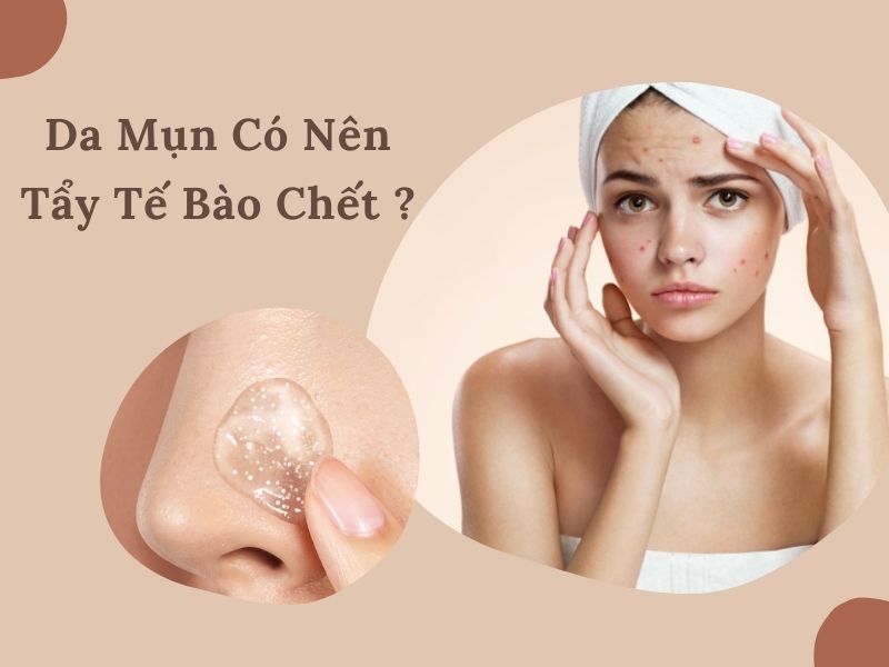 da mun co nen tay te bao chet khong can luu y nhung gi miri com.vn 7