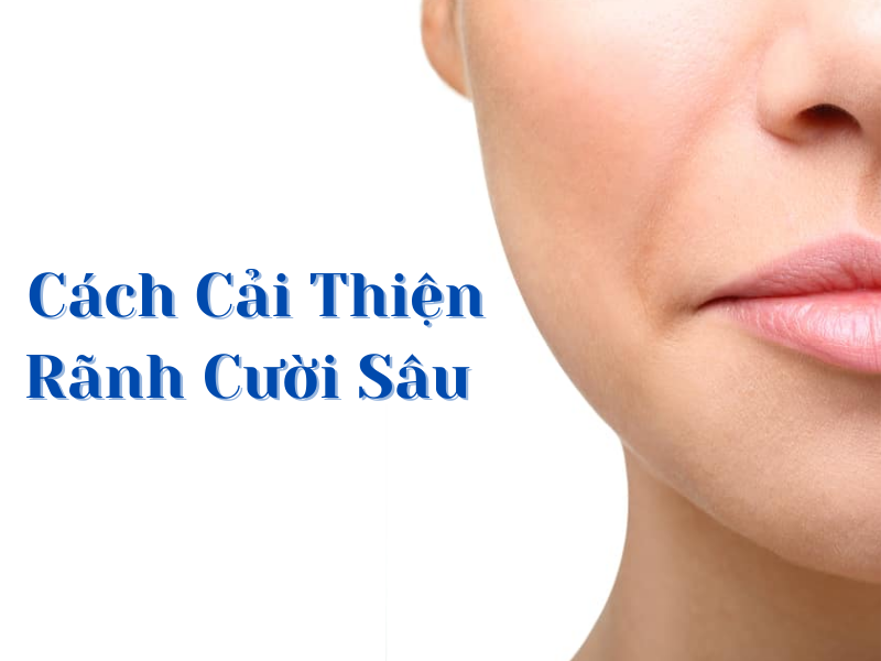 cach cai thien ranh cuoi sau giup tre hoa cho guong mat miri.com .vn 6