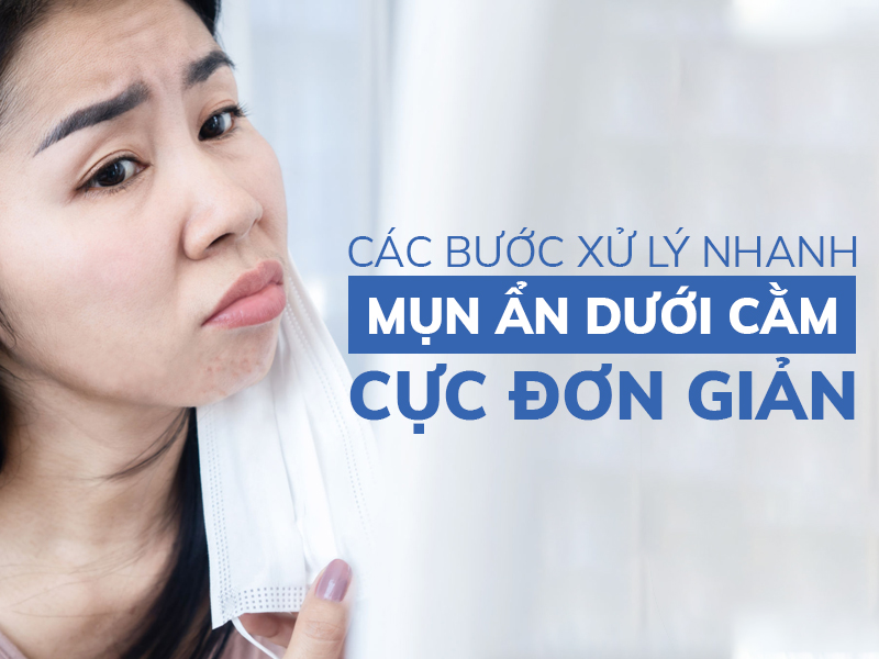 cac buoc xu ly nhanh mun an duoi cam cuc don gian miri.com .vn 8