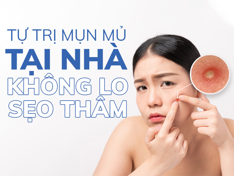 hoc cach tu tri mun mu tai nha khong lo seo tham miri.com .vn 8