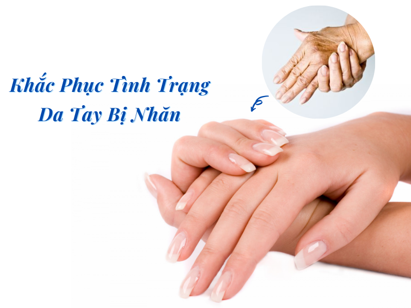 khac phuc tinh trang da tay bi nhan kho lao hoa miri.com .vn