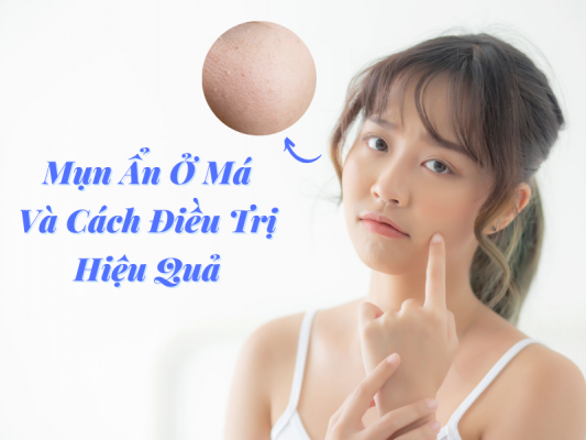 mun an o ma chia se cach dieu tri hieu qua miri.com .vn 8