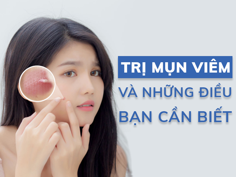tri mun viem va nhung dieu ban can biet miri.com .vn 4