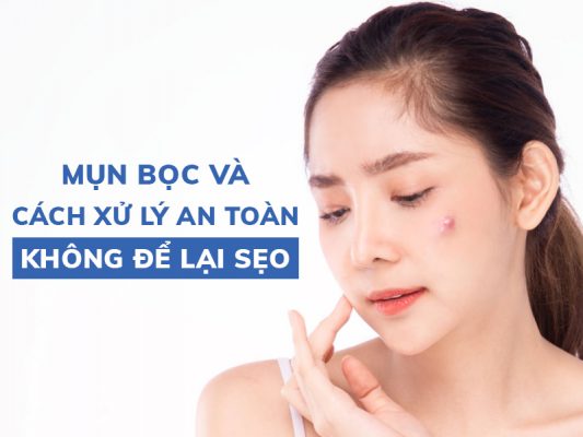 mun boc va cach xu ky an toan khong de lai seo miri.com .vn 9
