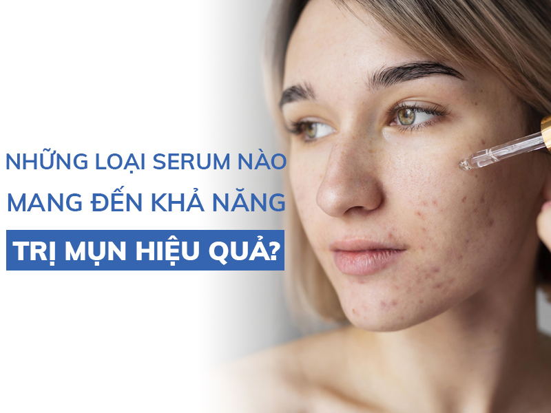nhung loai serum nao mang den kha nang tri mun hieu qua miri.com .vn 6