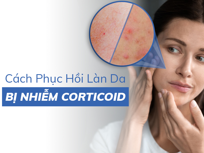 cach phuc hoi lan da bi nhiem corticoid nhanh va hieu qua miri.com .vn 5