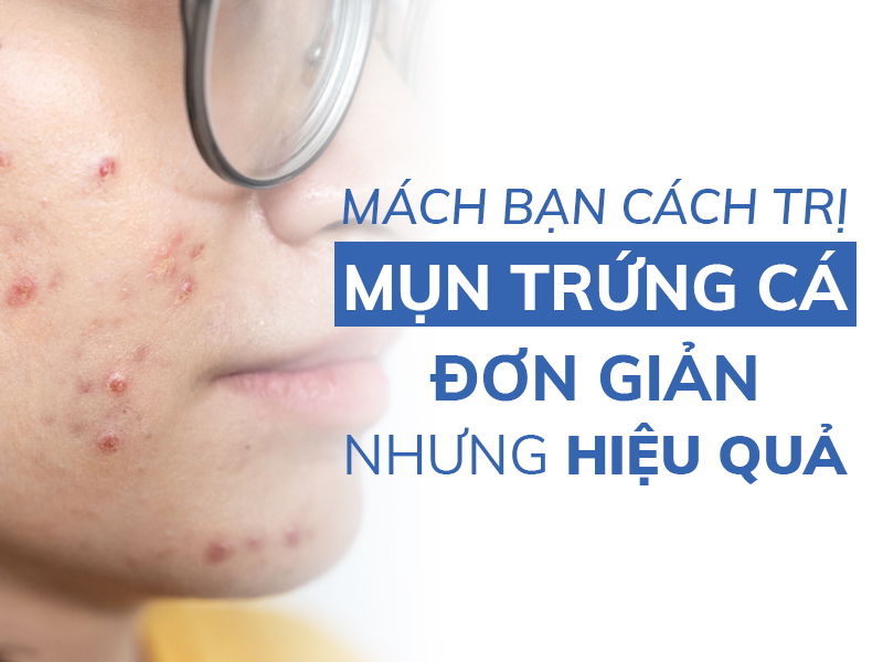 mach ban cach tri mun trung ca don gian nhung hieu qua 4 miri.com .vn