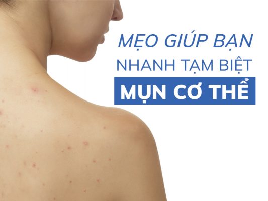 meo giup ban nhanh tam biet mun co the miri.com .vn 5