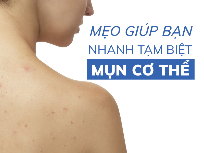 meo giup ban nhanh tam biet mun co the miri.com .vn 5
