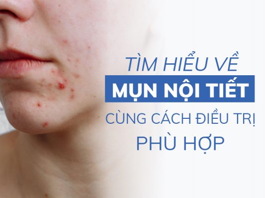 tim hieu ve mun noi tiet cung cach dieu tri phu hop niri.com .vn 4
