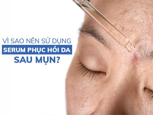 vi sao nen su dung serum phuc hoi da sau mun miri.com .vn 4