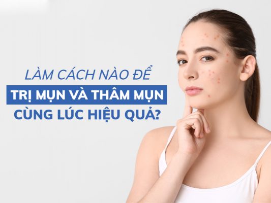 lam cach nao de tri mun va tham mun cung luc hieu qua miri.com .vn 3