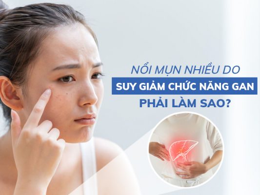 noi mun nhieu do suy giam chuc nang gan phai lam sao miri.com .vn 5