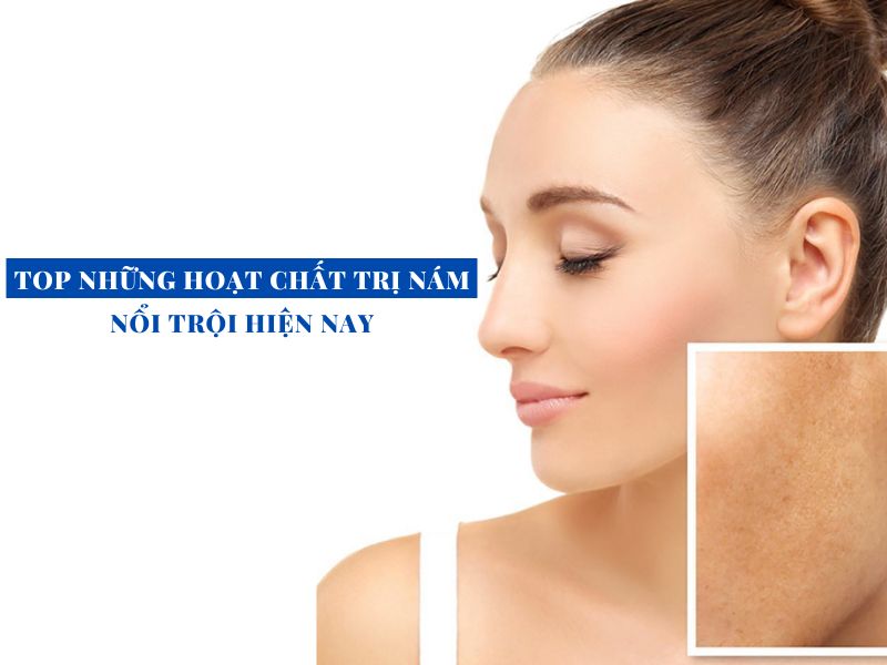 top nhung hoat chat tri nam noi troi hien nay miri.com .vn 5