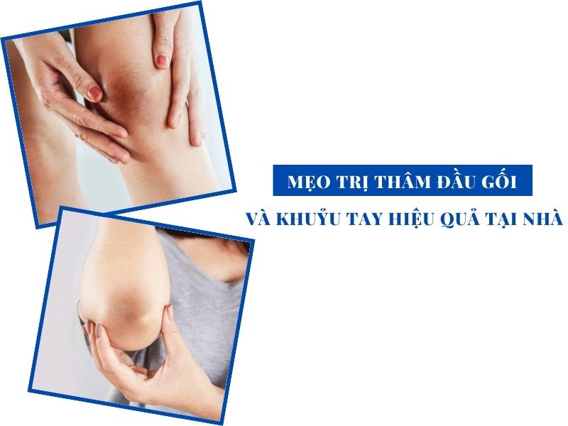 meo tri tham dau goi va khuyu tay hieu qua tai nha miri.com .vn 10