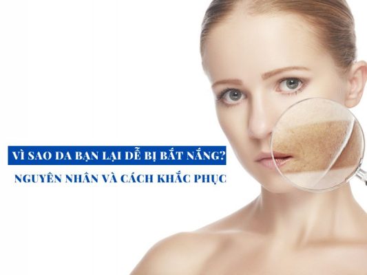 vi sao da ban lai de bi bat nang miri.com .vn 4