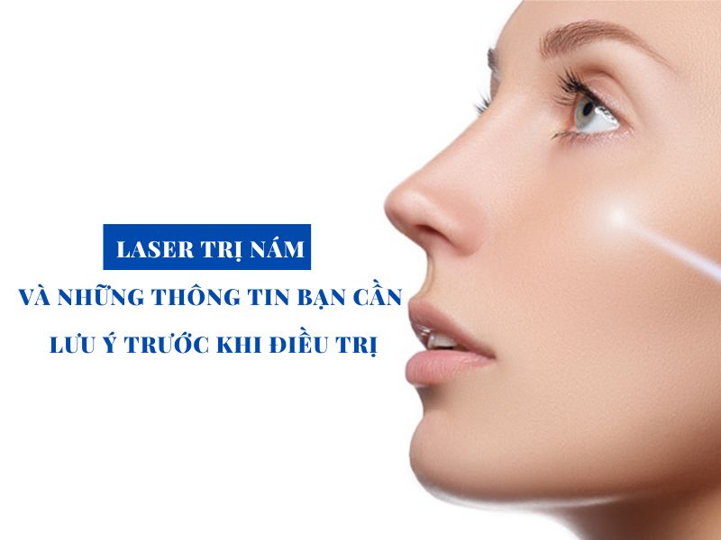 laser tri nam va nhung thong tin ban can luu y khi dieu tri miri.com .vn 5