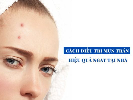 nguyen nhan va cach dieu tri mun tran hieu qua miri.com .vn 6