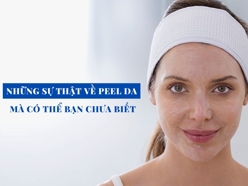 nhung su that ve peel da ma co the ban chua biet miri.com .vn 9