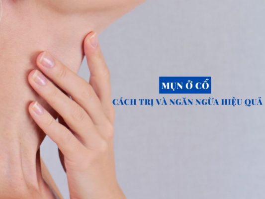 mun o co nguyen nhan hinh thanh cung cach tri miri.com .vn 6