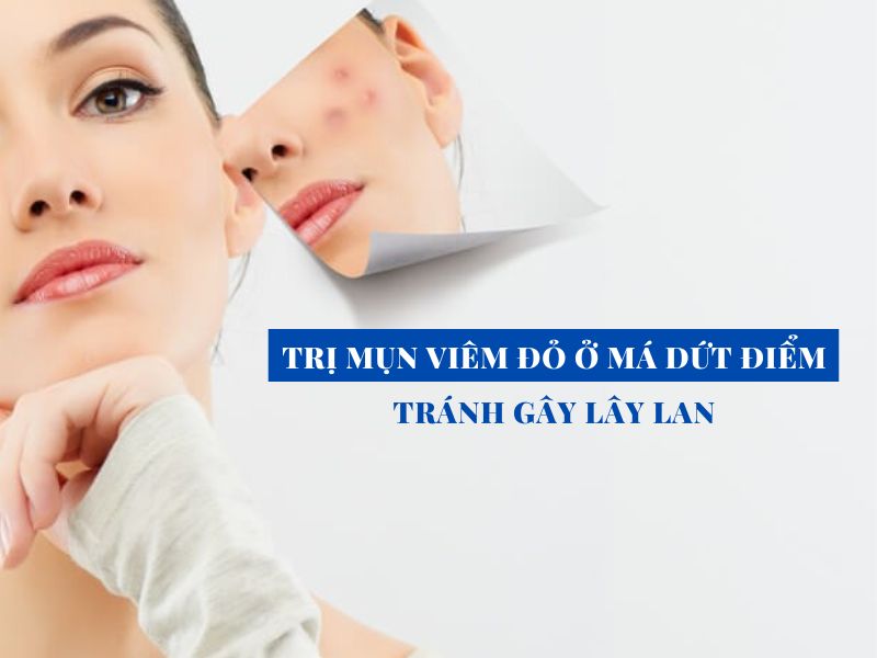 tri mun viem do o ma dut diem miri.com .vn 3