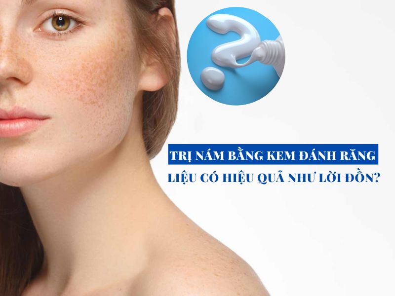 tri nam bang kem danh rang lieu co hieu qua nhu loi don miri.com .vn 5