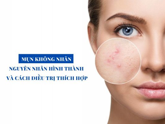 mun khong nhan nguyen nhan hinh thanh va cach dieu tri miri.com .vn 3