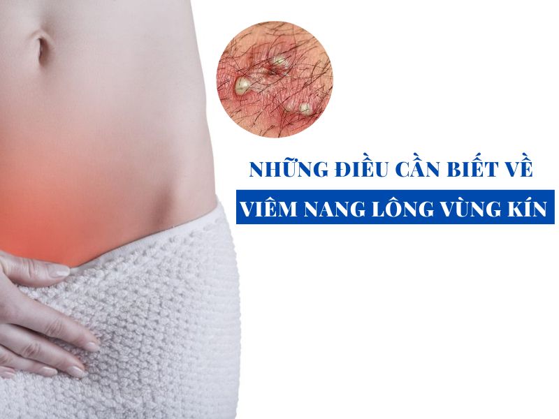 nhung dieu can biet ve viem nang long vung kin miri.com .vn 4