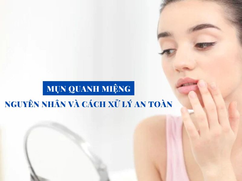 mun quanh mieng nguyen nhan va cach xu ly an toan miri.com .vn 6