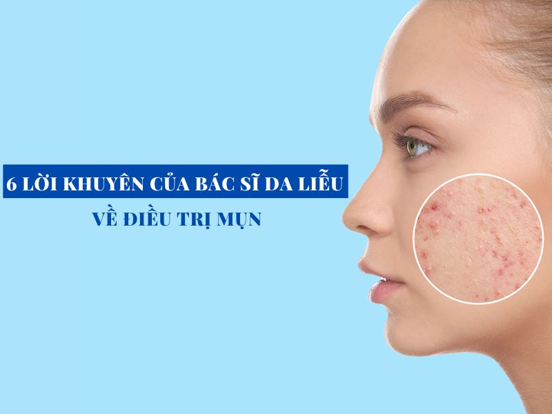 6 loi khuyen cua ba si da lieu ve dieu tri mun miri.com .vn 4