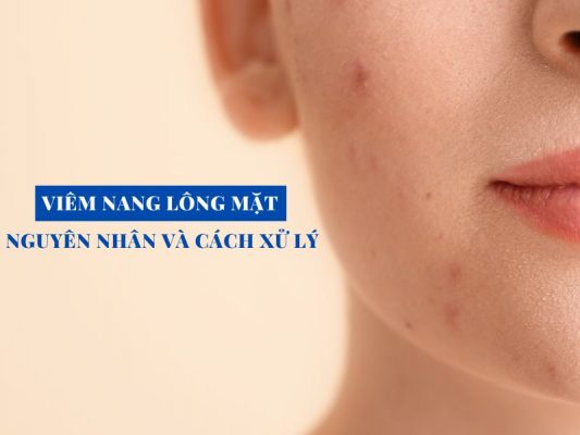 viem nang long mat nguyen nhan hinh thanh va cach xu ly miri.com .vn 6