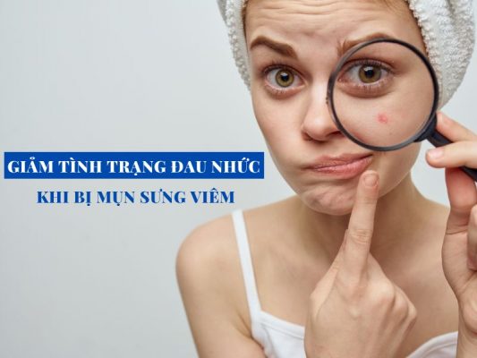 cach giam tinh trang dau nhuc khi bi mun sung viem miri.com .vn 4