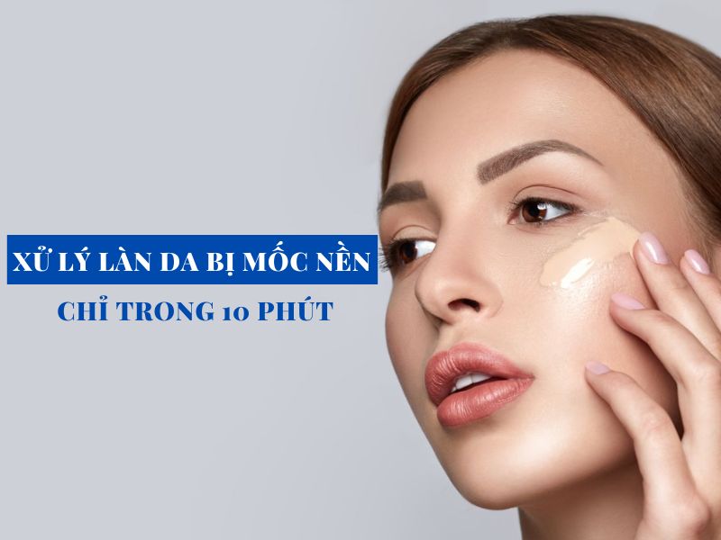 xu ly lan da bi moc nen chi trong 10 phut miri.com .vn 5