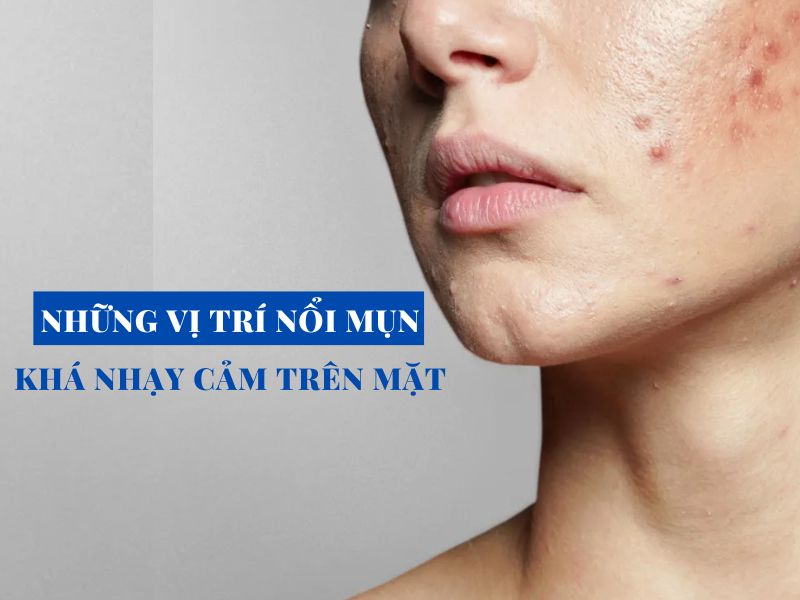 nhung vi tri noi mun kha nhay cam tren mat miri.com .vn 6