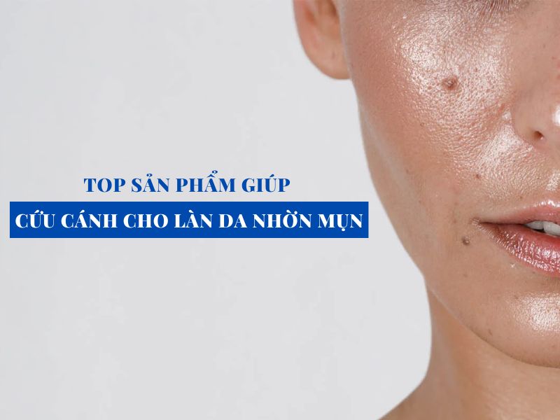 top san pham cuu canh cho lan da nhon mun miri.com .vn 13