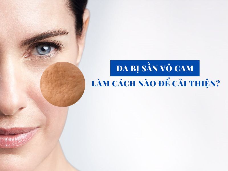 da bi san vo cam lam cach nao de cai thien miri.com .vn 6