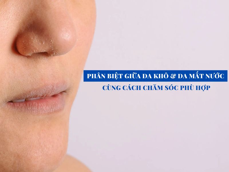 phan biet giua da kho va da mat nuoc miri.com .vn 5