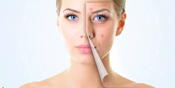 nen boi kem tri mun hay tri tham truoc 1